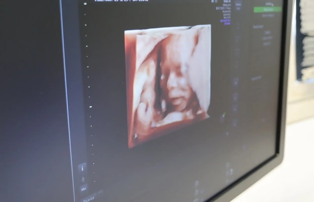 Centro sanitario Unical, nuovi servizi di diagnosi prenatale per le future mamme