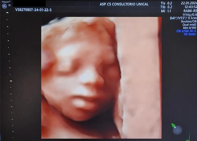 Centro sanitario Unical, nuovi servizi di diagnosi prenatale per le future mamme